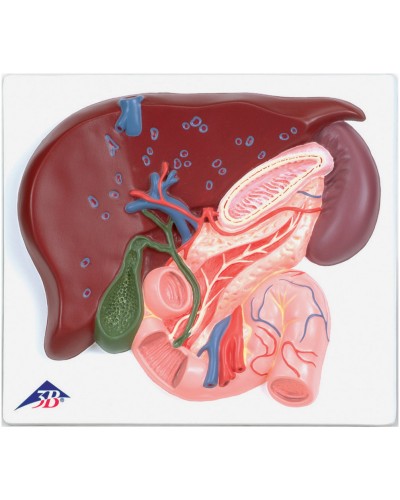 Liver with Gall Bladder, Pancreas and Duodenum